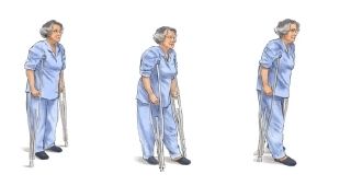 Патерици и бастуни под наем